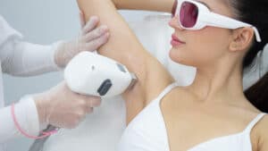 Depilación laser axilas