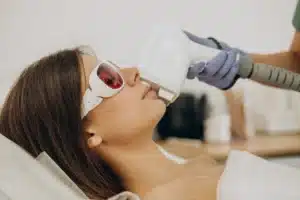 ¿Cómo eliminar el vello facial definitivamente en mujeres?